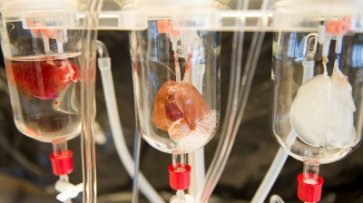 Впервые в истории выращенные в лаборатории клетки сердечной мышцы пересадили человеку - «Здоровье»