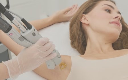 Лазерная эпиляция в Красноярске и безопасный загар: как спланировать процедуры к лету